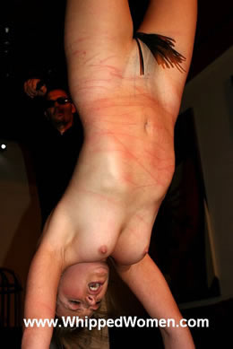 Attention: extreme welted skin of a young female!